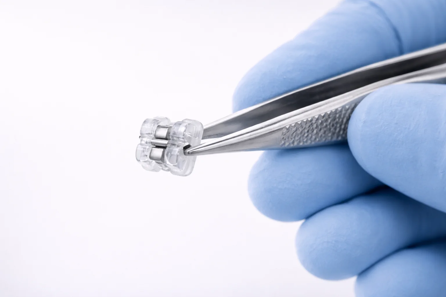 Ортодонтія у Харкові